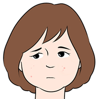大人ニキビの悩み