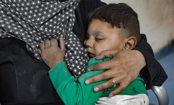 A young boy in Gaza waits to be seen in a hospital in Gaza after being caught in an attack. (file)