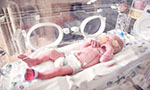 Photo of a baby lying in the incubator.