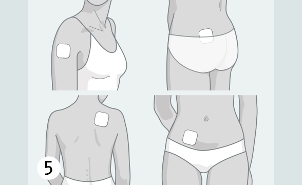 (Quelle: BIÖG) Kleben Sie sich das Pflaster auf den Bauch, den Po, das Schulterblatt oder die Außenseite des Oberarms. Die Haut muss trocken und darf an dieser Stelle nicht eingecremt sein.