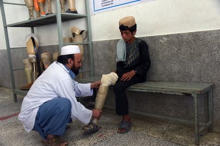 Ein Junge mit Prothese wird von einem HI-Spezialisten behandelt.