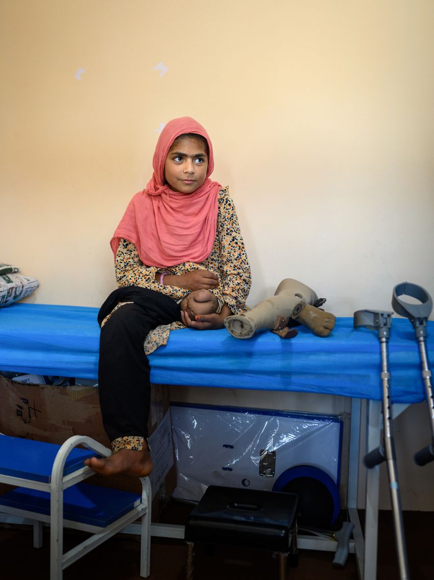 Mädchen sitzt auf einer Pritsche, neben ihr eine Prothese. Ihr fehlt das linke Bein.