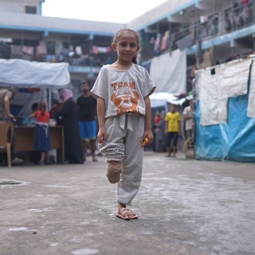 Ein Mädchen mit Beinamputation steht auf einem großem Hof. Um sie herum sind einige Menschen. 