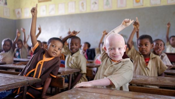 Eine Schulklasse. Die Schüllerinnen und Schüler grinsen in die Kamera. Im Vordergrund ein Junge mit Albinismus.