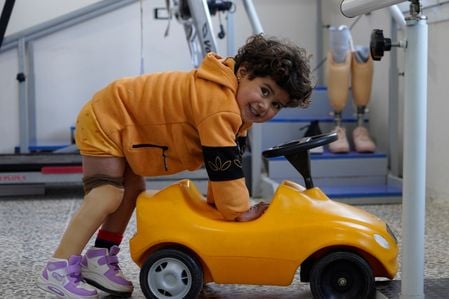 Ein kleines Mädchen mit Prothese und stützt sich auf ein Spielzeugauto.