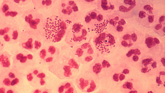 NeisseriaGonorrhoeae_resized