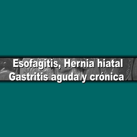 Esofagitis, Hernia hiatal, gastritis aguda.ppt