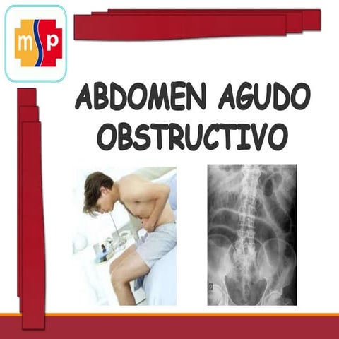 Abdomen agudo obstructivo 