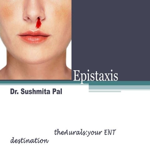 Epistaxis