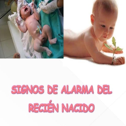 signos de Alarma del Recién Nacido