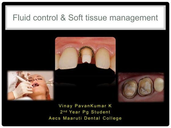 Fluid control and Soft tissue management in Prosthodontics
