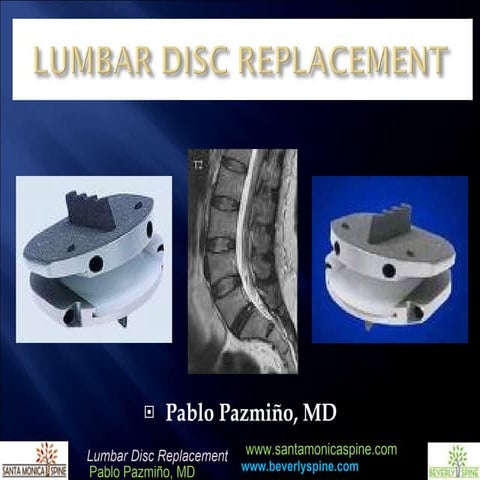 Lumbar Disc Replacement