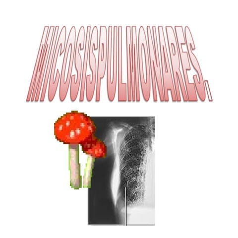Micosis pulmonares