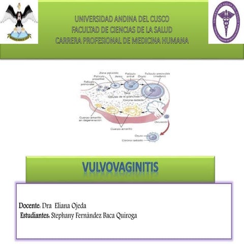  vulvovaginitis Universidad Andina del Cusco  facultad de medicina 