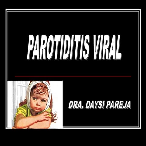 INFECTOLOGIA II - Parotiditis