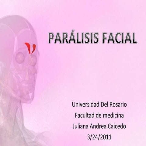 Presetación parálisis facial