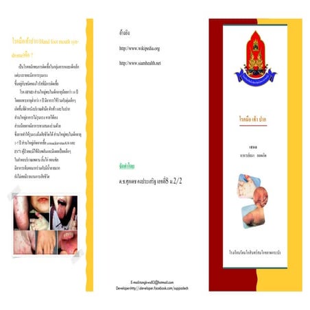 แผ่นพับ โรคมือเท้าปาก
