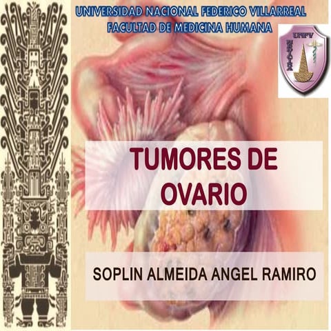 TUMORES DE OVARIO