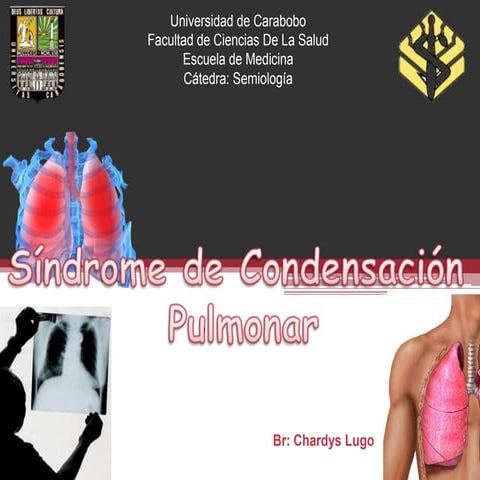 Sindrome de condensacion