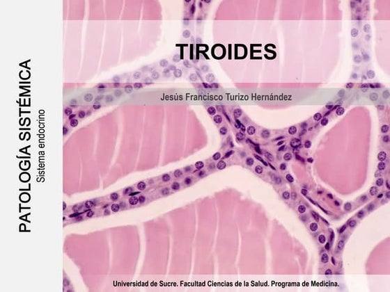 Patología del tiroides