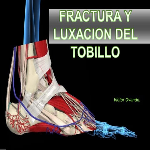 Trabajo frac y lux 2