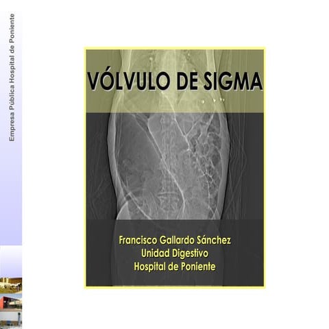 Vólvulo de colon