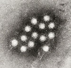 Hepatitis A virus Hepatitis A virus