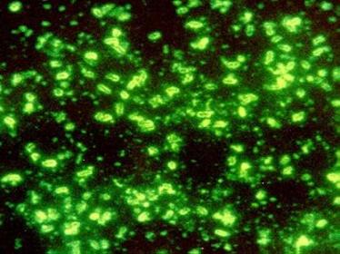Yersinia pestis Yersinia pestis