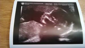 20 week roo