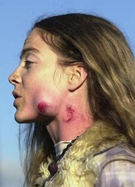 rubber-bullets-peaceful-protester