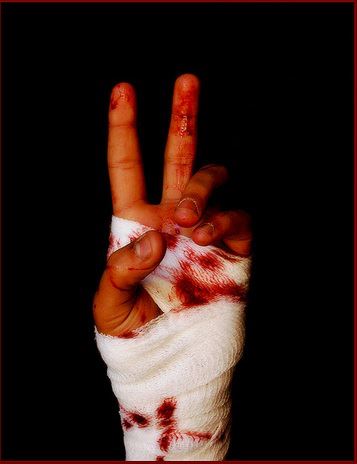 Love Peace And Bandages