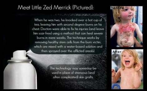Meet Little Zed Merrick When He Was Two