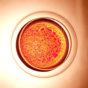 1 1
