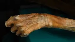 Una fotografía en primer plano de las manos del Hombre de Hielo, donde se aprecian unas tenues líneas negras tatuadas en la muñeca.