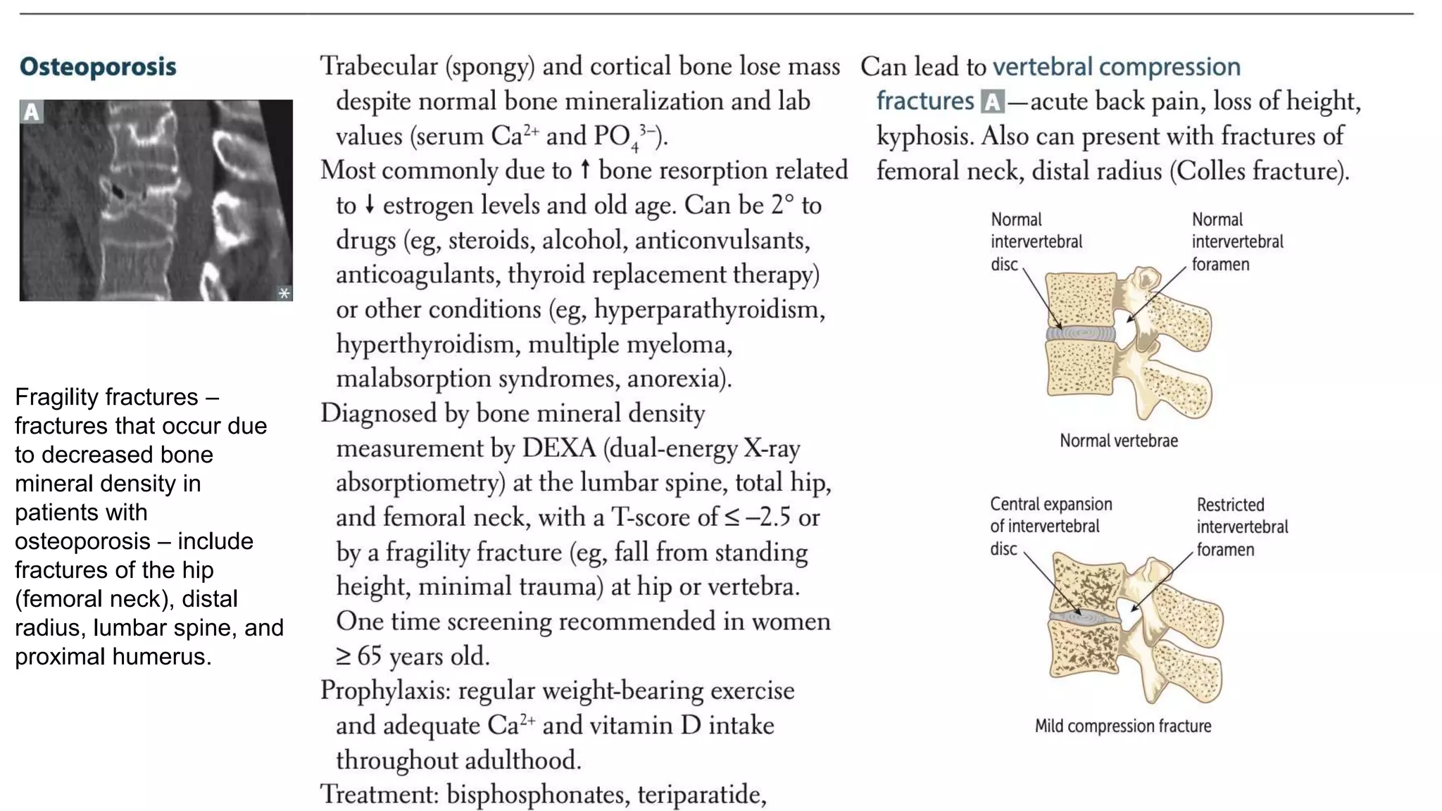 Fragility fractures –
fractures that occur due
to decreased bone
mineral density in
patients with
osteoporosis – include
fractures of the hip
(femoral neck), distal
radius, lumbar spine, and
proximal humerus.
 