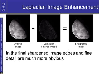 16
                                                             of
                                                             30
                                                                                Laplacian Image Enhancement
Images taken from Gonzalez & Woods, Digital Image Processing (2002)




                                                                                    -                    =
                                                                         Original          Laplacian         Sharpened
                                                                         Image          Filtered Image         Image

                                                                      In the final sharpened image edges and fine
                                                                      detail are much more obvious
 