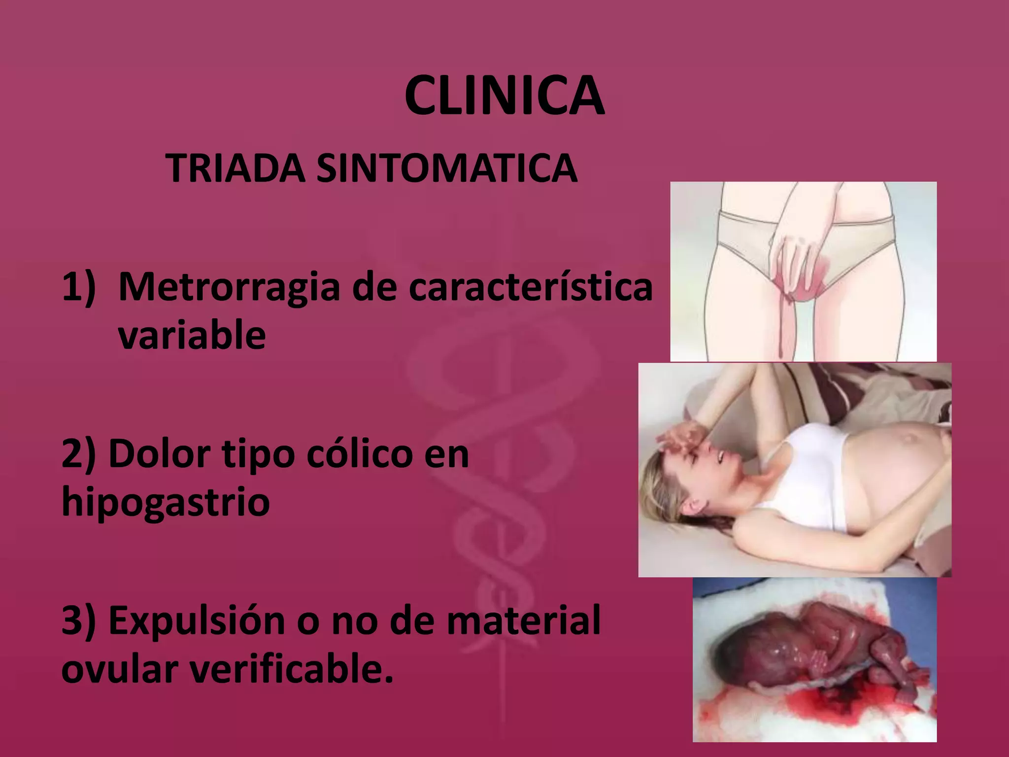 CLINICA
TRIADA SINTOMATICA
1) Metrorragia de característica
variable
2) Dolor tipo cólico en
hipogastrio
3) Expulsión o no de material
ovular verificable.
 