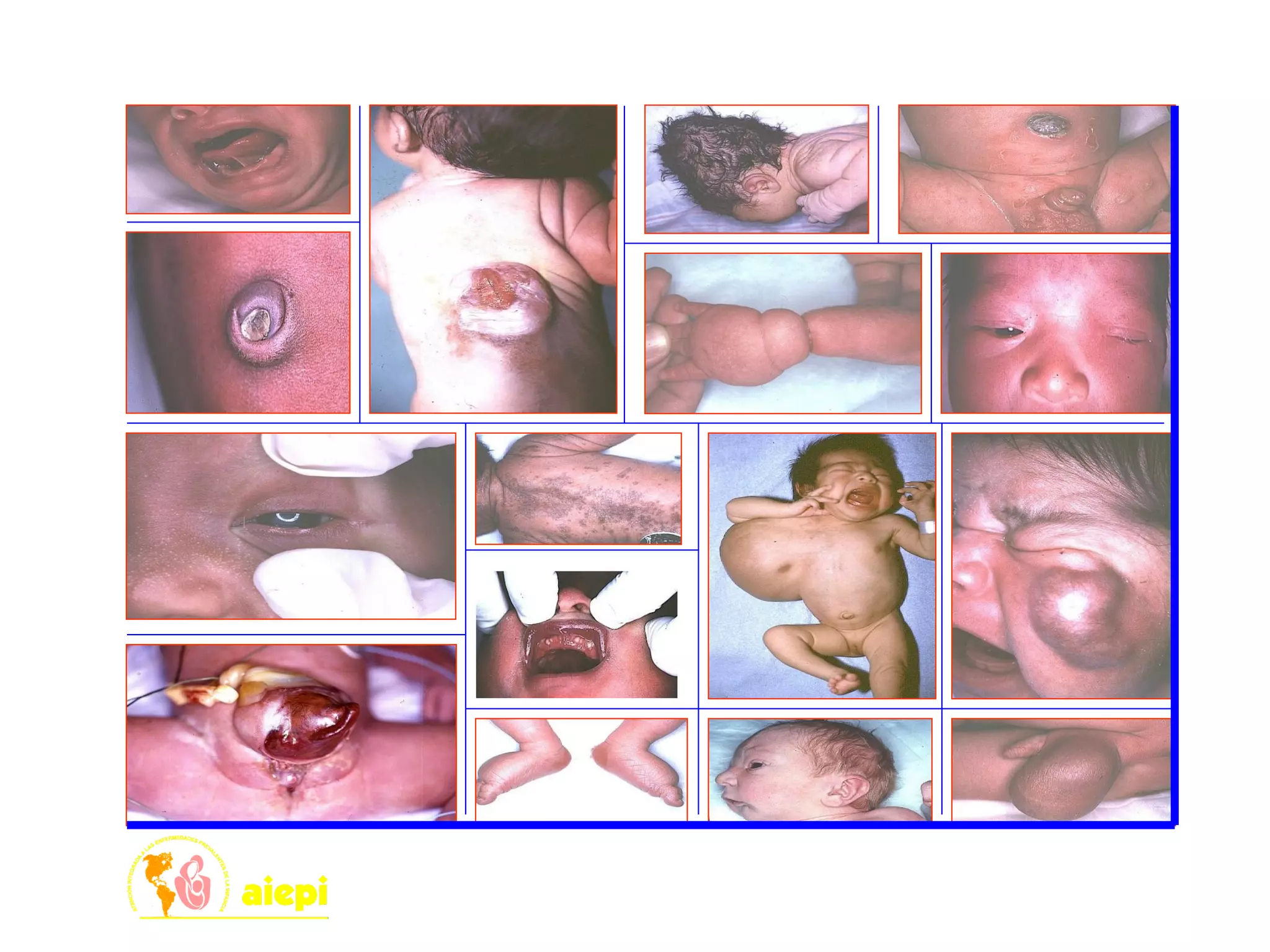 EVALUAR OTROS PROBLEMAS
 