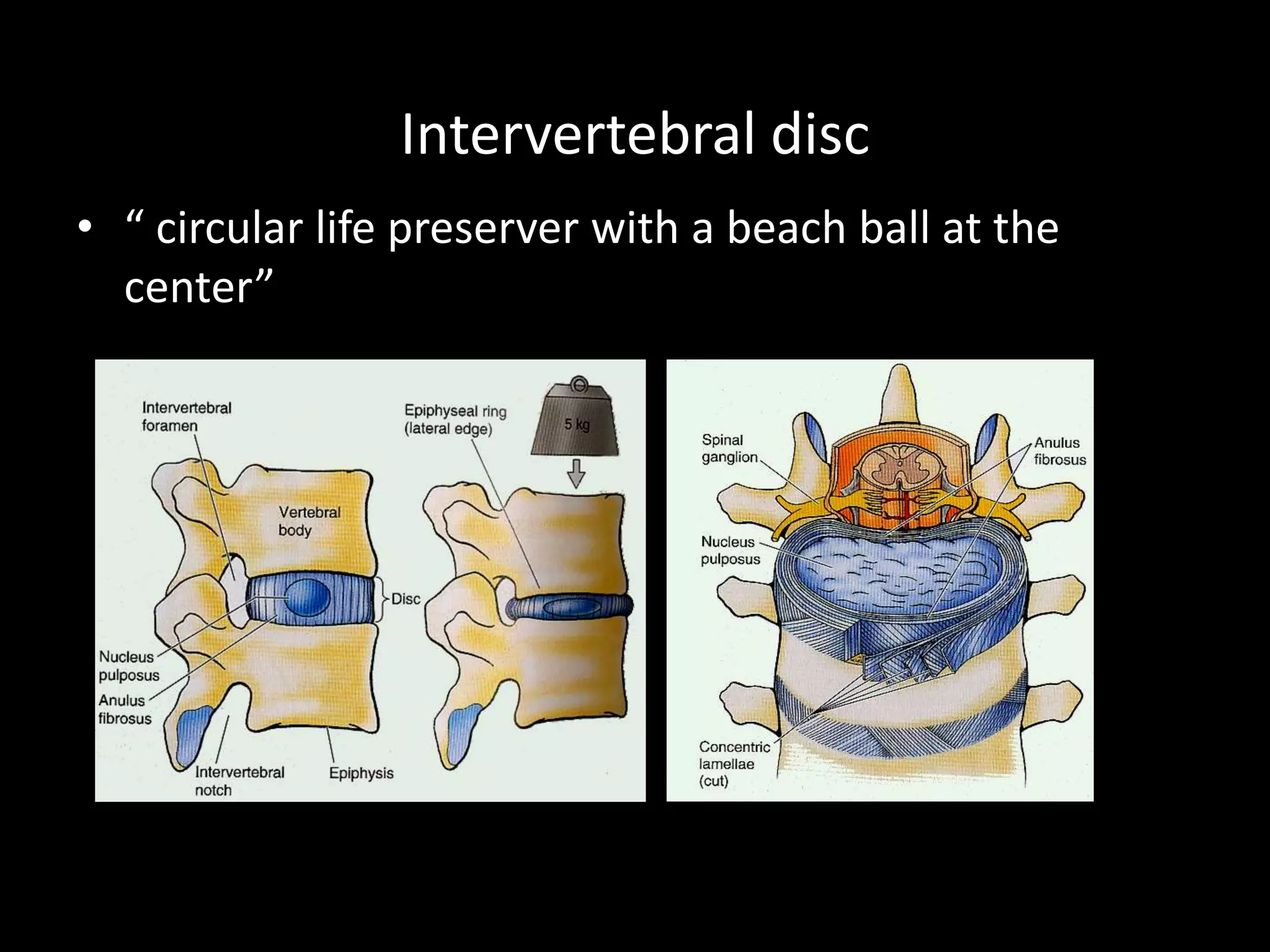 Intervertebral disc
• “ circular life preserver with a beach ball at the
center”
 