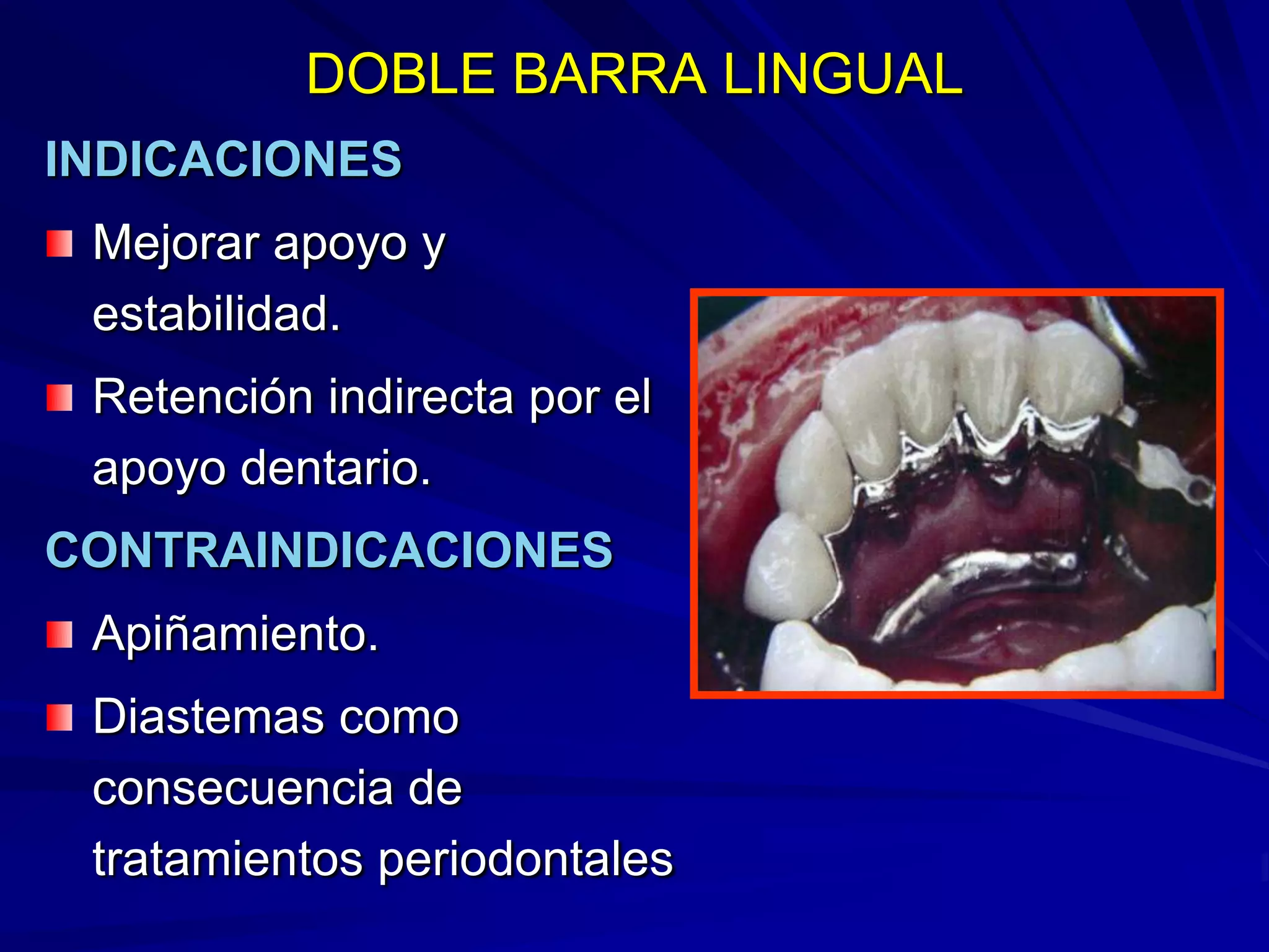 Conectores Mayores Y Apoyos
