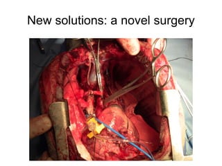 New  solutions:  a  novel  surgery
 