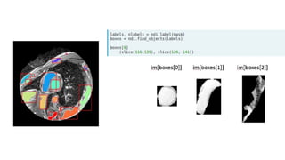 Image analysis using python