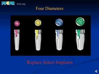 Four Diameters 3.5mm 4.3mm 5.0mm 6.0mm Replace Select Implants 2.4mm 2.7mm 3.25mm 3.8mm 