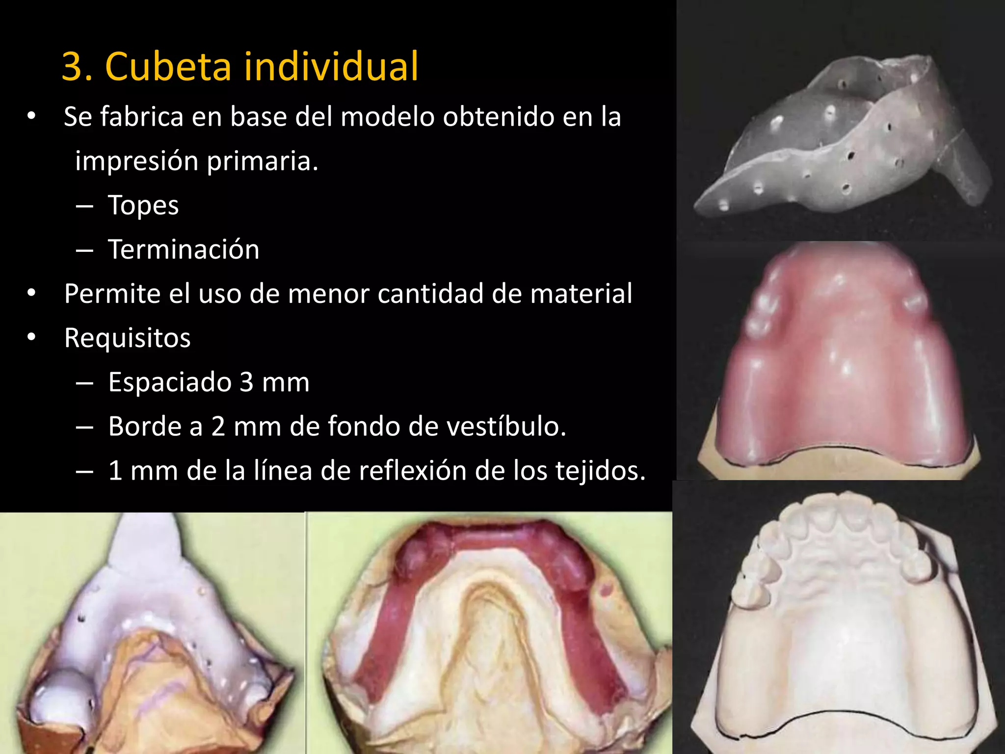 3. Cubeta individual
• Se fabrica en base del modelo obtenido en la
impresión primaria.
– Topes
– Terminación
• Permite el uso de menor cantidad de material
• Requisitos
– Espaciado 3 mm
– Borde a 2 mm de fondo de vestíbulo.
– 1 mm de la línea de reflexión de los tejidos.
 