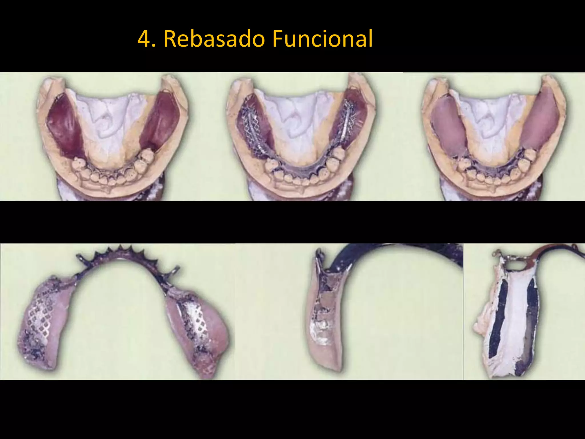 4. Rebasado Funcional
 