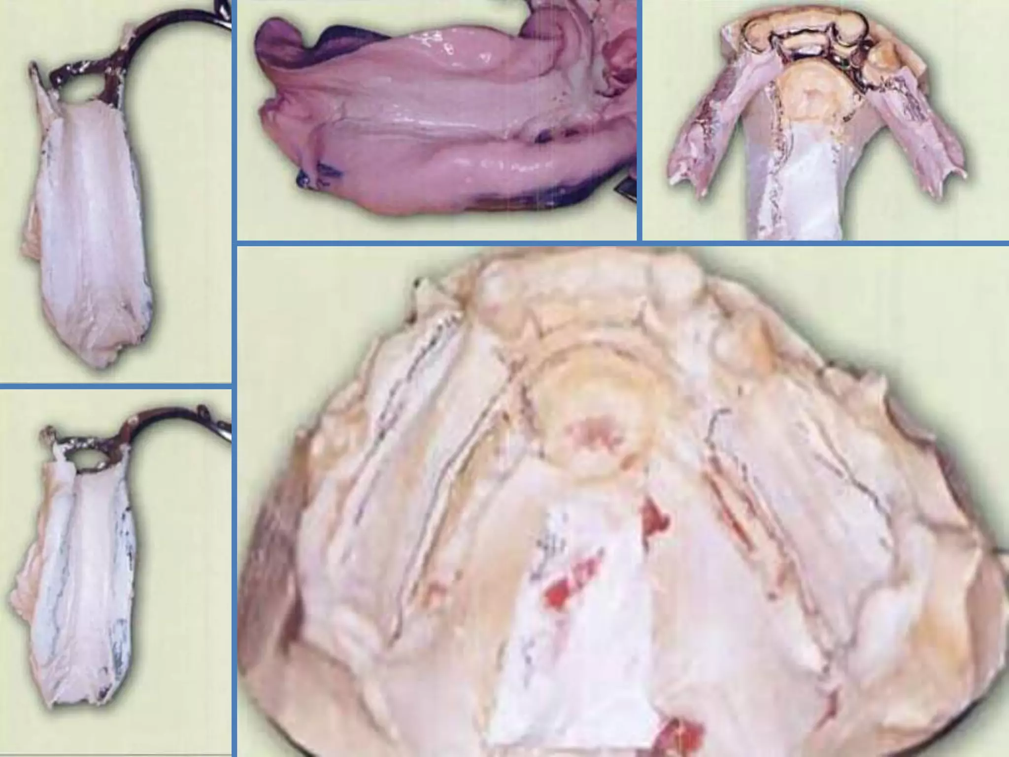 5/1/2013
Dr. Daniel Vega Adauy. Especialista en
Rehabilitación Oral
41
 