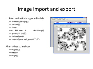 Image import and export
• Read and write images in Matlab
>> I=imread('cells.jpg');
>> imshow(I)
>> size(I)
ans = 479 600 3 (RGB image)
>> Igrey=rgb2gray(I);
>> imshow(Igrey)
>> imwrite(lgrey, 'cell_gray.tif', 'tiff')
Alternatives to imshow
>>imagesc(I)
>>imtool(I)
>>image(I)
 