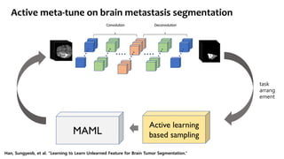 Active meta-tune on brain metastasis segmentation
Convolution Deconvolution
Active learning
based samplingMAML
task
arrang
ement
Han, Sungyeob, et al. “Learning to Learn Unlearned Feature for Brain Tumor Segmentation.”
 