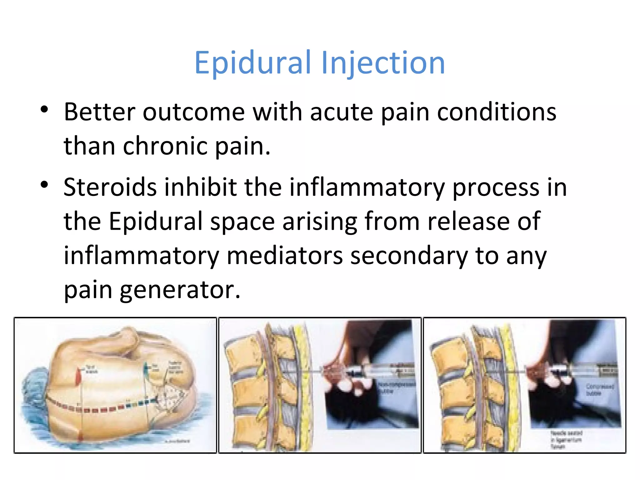 Epidural Injection
• Better outcome with acute pain conditions
than chronic pain.
• Steroids inhibit the inflammatory process in
the Epidural space arising from release of
inflammatory mediators secondary to any
pain generator.
 