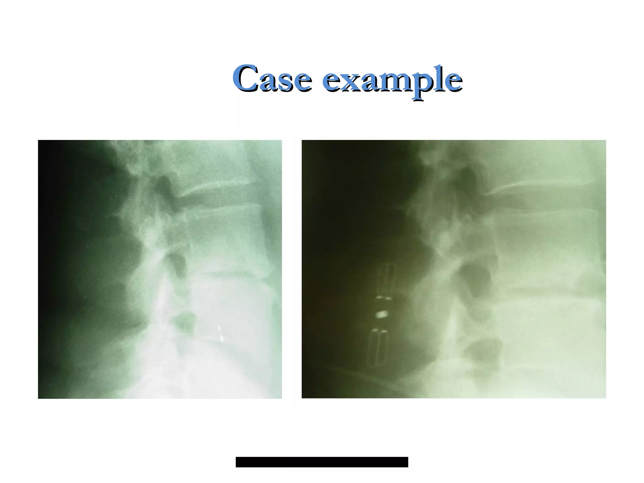 Case exampleCase example
 